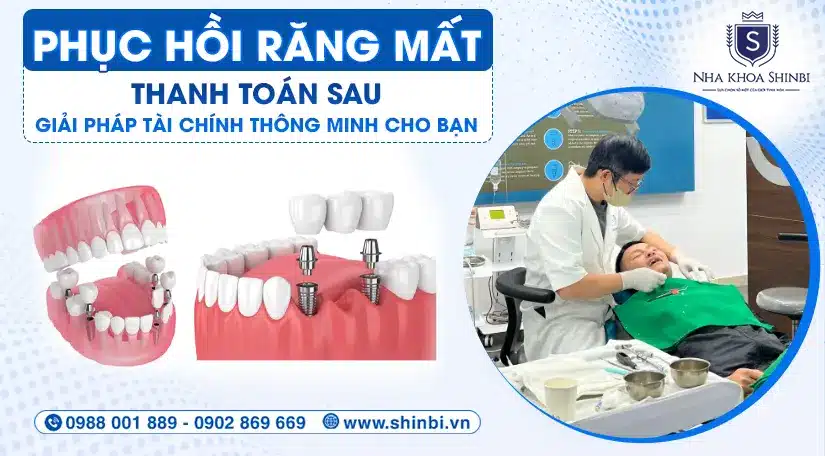 Phục hồi răng mất – Thanh toán sau: Giải pháp tài chính thông minh cho bạn