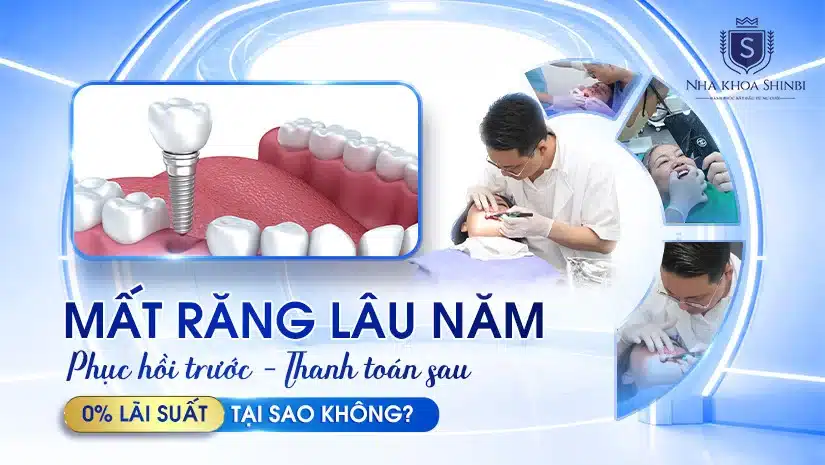 Phục hồi răng mất - Thanh toán sau: Giải pháp tài chính thông minh cho bạn