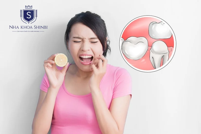 Răng sứ bị ê buốt sau khi làm: nguyên nhân và khi nào cần đi kiểm tra