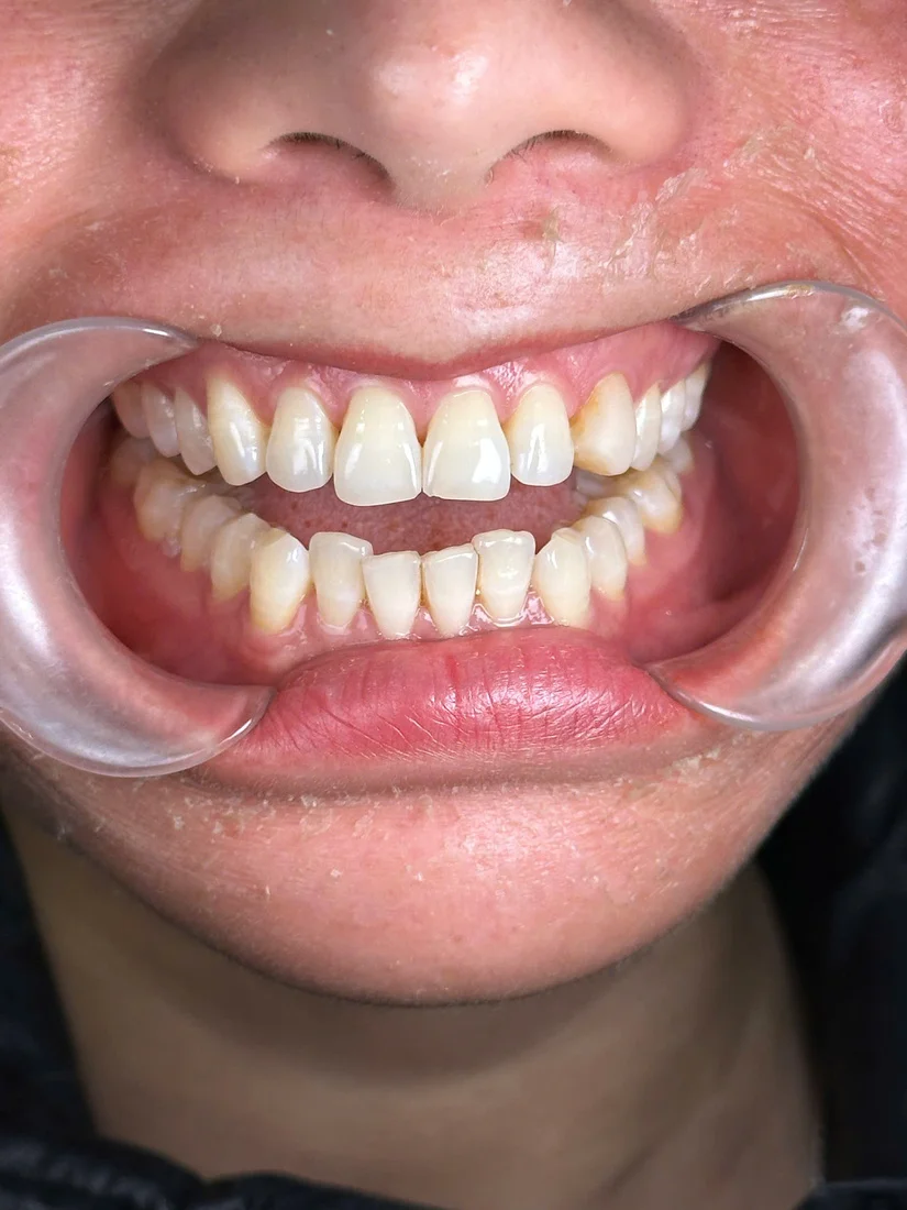 Shinbi Dental - Nha khoa thẩm mỹ uy tín gần phố Trần Hưng Đạo