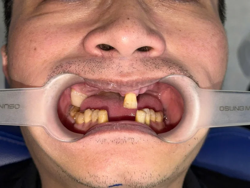 Tìm phòng khám nha khoa cao cấp gần Ngân hàng/Đại sứ quán phố Trần Hưng Đạo
