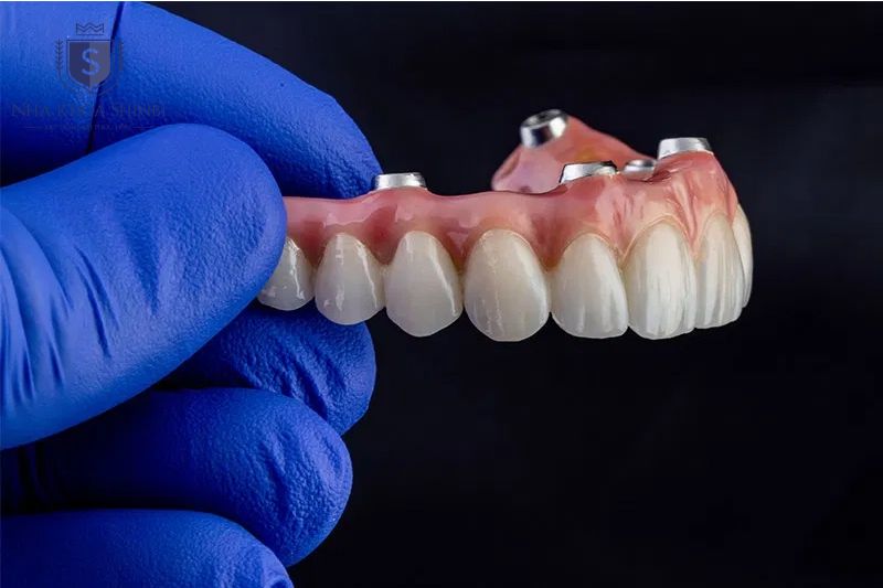 All on 4 giúp tiết kiệm chi phí nhờ giảm số trụ và vật liệu cần dùng