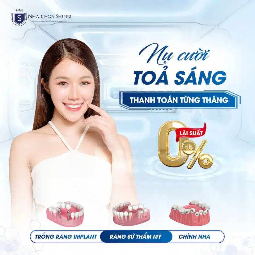 Niềng răng mắc cài kim loại: cấu tạo – chi phí – đối tượng phù hợp