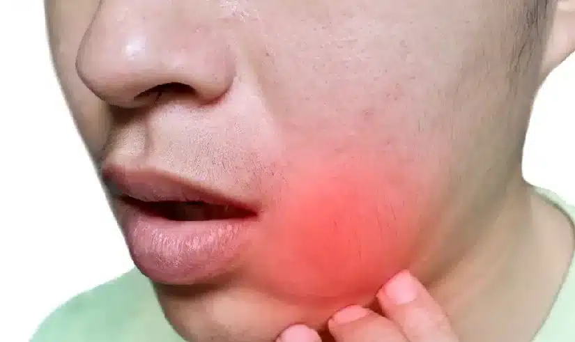 Răng khôn (răng số 8) là gì? Khi nào mọc?