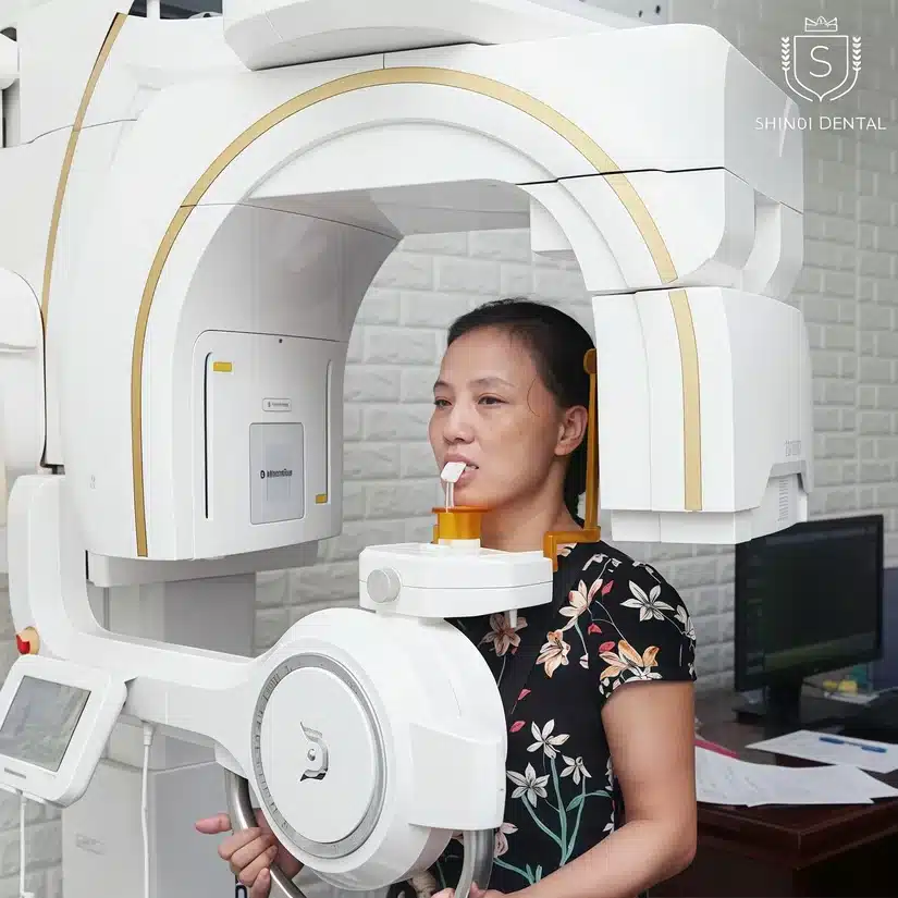 Xương hàm lệch có niềng răng được không?