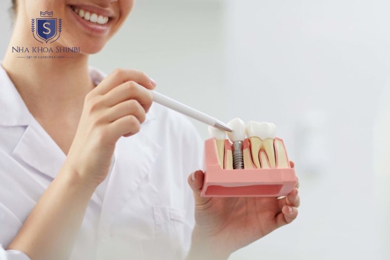 Cấy ghép Implant được chỉ định khi mất răng cần phục hình cố định và bảo tồn xương hàm lâu dài