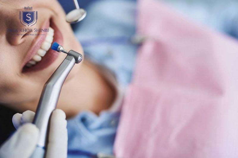 Điều trị chảy máu chân răng cần xác định đúng nguyên nhân và can thiệp nha khoa kịp thời