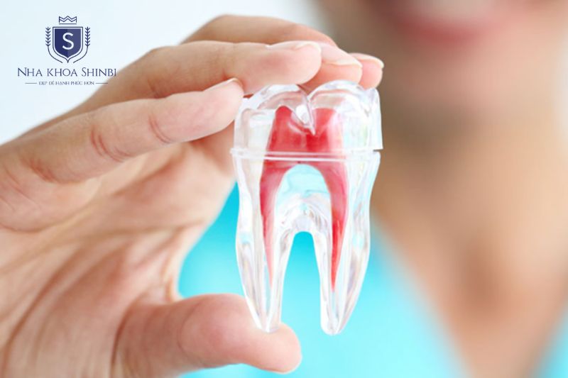 Điều trị tủy loại bỏ nhiễm trùng và cần bọc sứ để bảo vệ răng sau đó