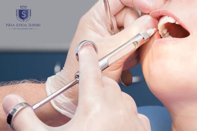 Gây tê cục bộ giúp cấy ghép Implant không đau và chỉ ê nhẹ sau phẫu thuật