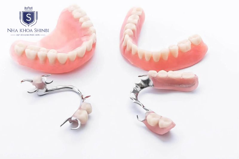 Implant bảo tồn răng thật ngăn tiêu xương chi phí tùy trụ Nha Khoa Shinbi