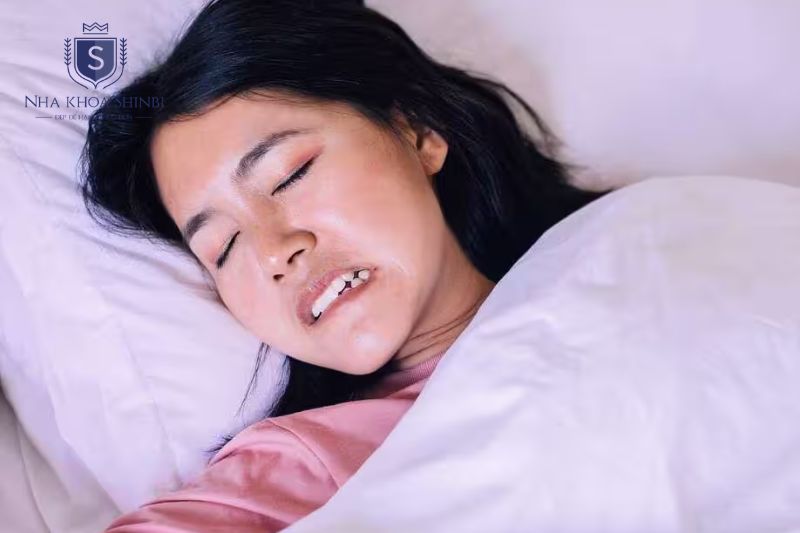 Máng nhai ban đêm giúp giảm lực nghiến bảo vệ vít abutment và hạn chế lỏng tầng hai