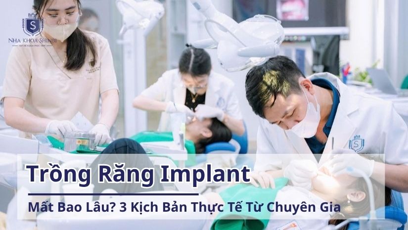 Trồng Răng Implant Mất Bao Lâu? Các Yếu Tố Nào Ảnh Hưởng