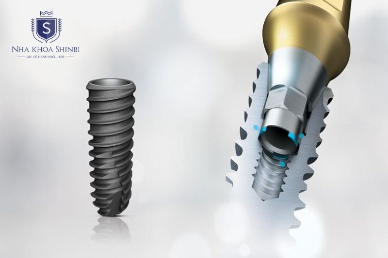 Trụ Implant Dentium được các nha khoa tầm trung lựa chọn phổ biến