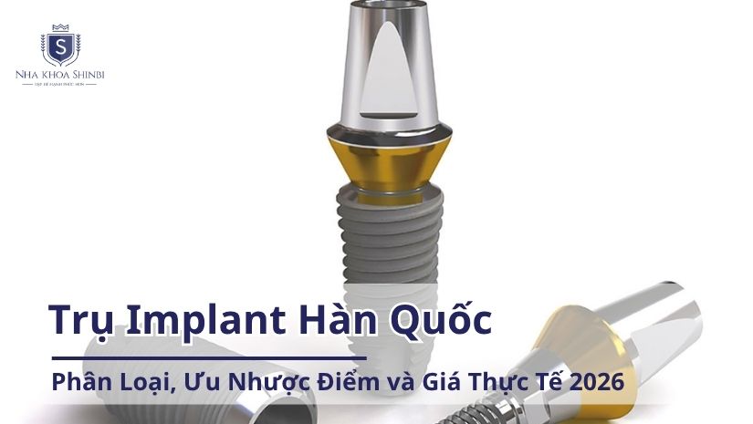Trụ Implant Hàn Quốc: Phân Loại, Ưu Nhược Điểm và Giá Thực Tế 2026