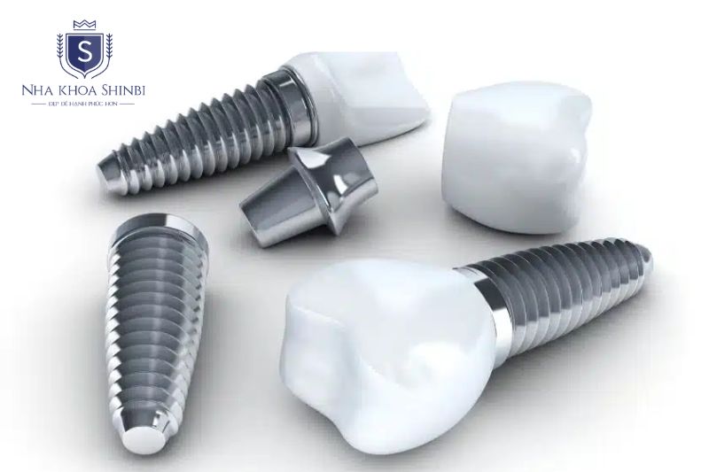 Trụ titanium kém chất lượng giảm tích hợp dễ gãy và không đảm bảo bảo hành lâu dài