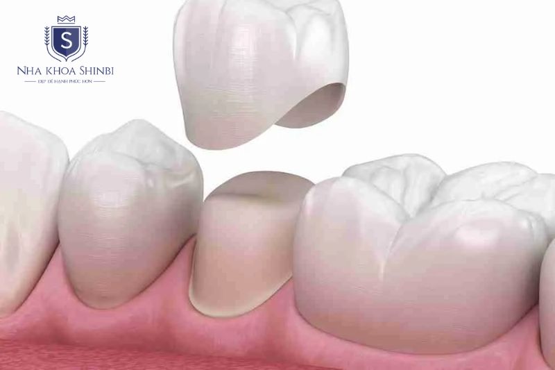 Xử lý lỏng tầng một hai bằng siết vít đúng lực và thay mão khi cần