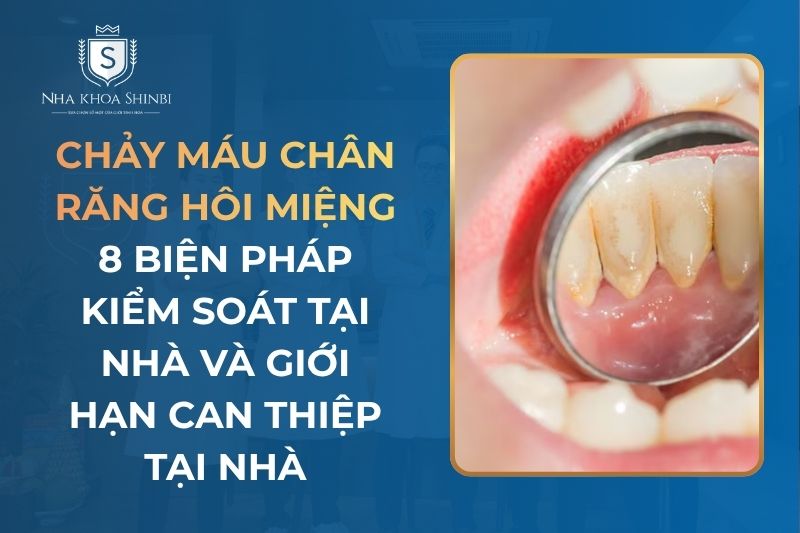 Chảy Máu Chân Răng Hôi Miệng Và Cách Điều Trị Tại Nhà