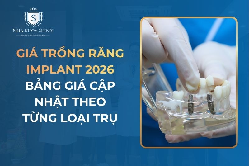 Trồng Răng Implant Bao Nhiêu Tiền? Bảng Giá Trồng Implant Mới Nhất 2026