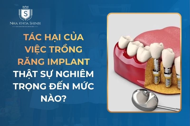 Tác Hại Của Việc Trồng Răng Implant: Thật Sự Nghiêm Trọng Đến Mức Nào?