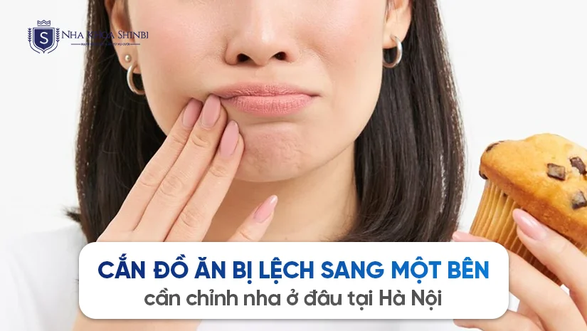 Cắn đồ ăn bị lệch sang một bên cần chỉnh nha ở đâu tại Hà Nội