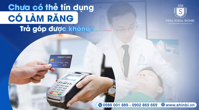 Chưa có thẻ tín dụng có làm răng trả góp được không?