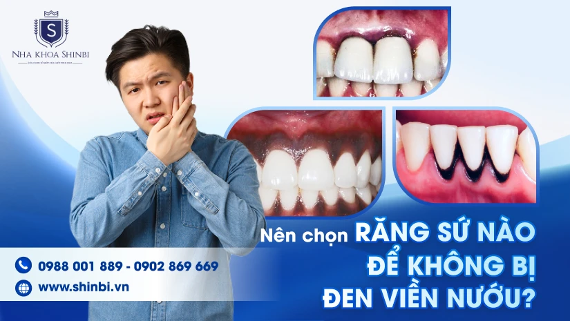 Nên chọn răng sứ nào để không bị đen viền nướu?