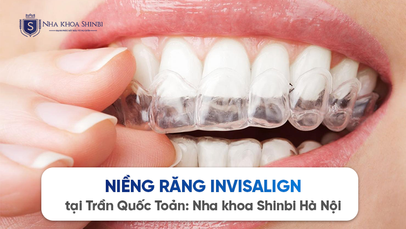 Niềng răng Invisalign tại Trần Quốc Toản: Nha khoa Shinbi Hà Nội