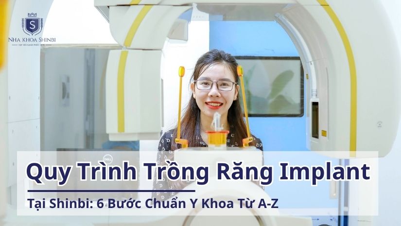 Quy Trình Trồng Răng Implant Tại Shinbi: 6 Bước Chuẩn Y Khoa Từ A-Z