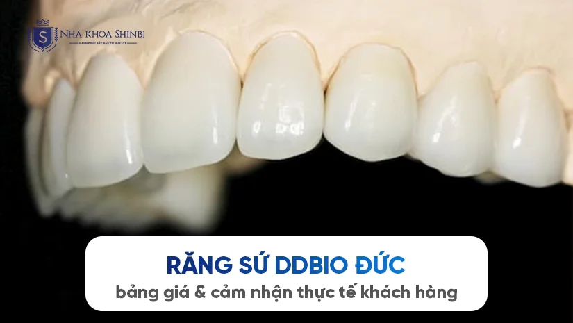 Răng sứ DDBio Đức: bảng giá & cảm nhận thực tế