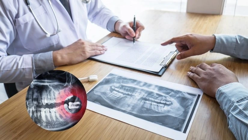 Top 5 bác sĩ nhổ răng khôn giỏi, uy tín nhất tại Hà Nội
