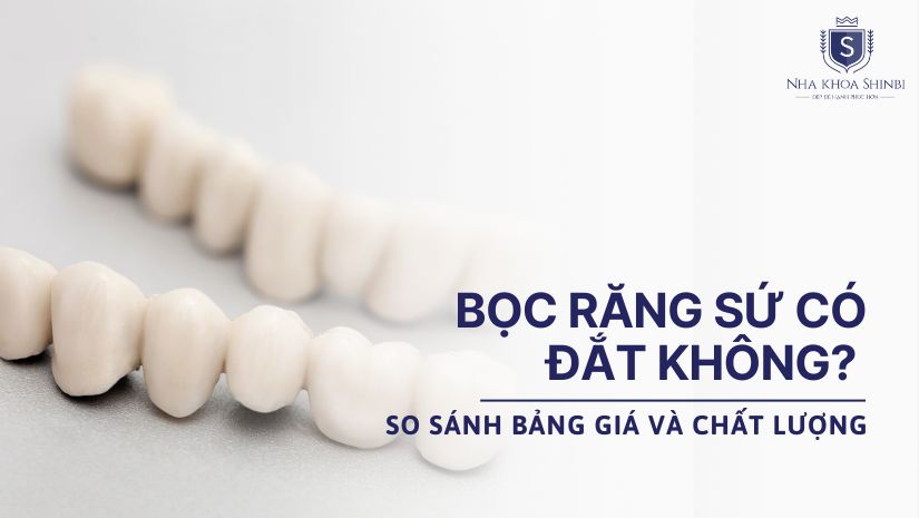 Bọc răng sứ có đắt không? So sánh bảng giá và chất lượng