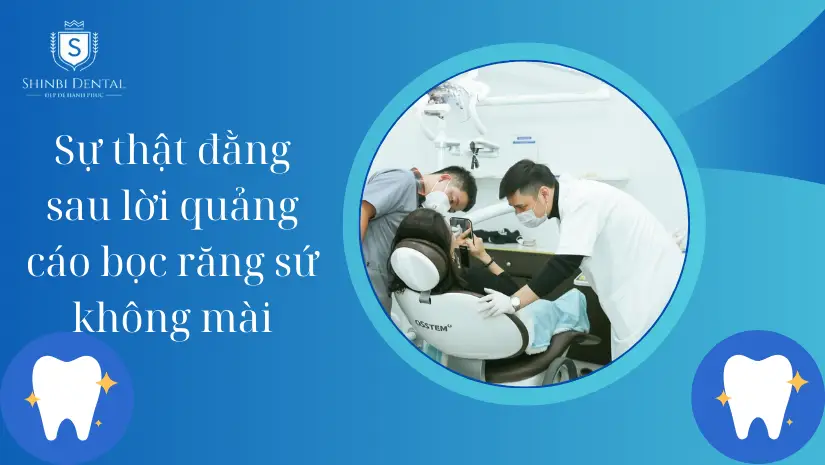 Bọc răng sứ không mài giá bao nhiêu? Bảng giá
