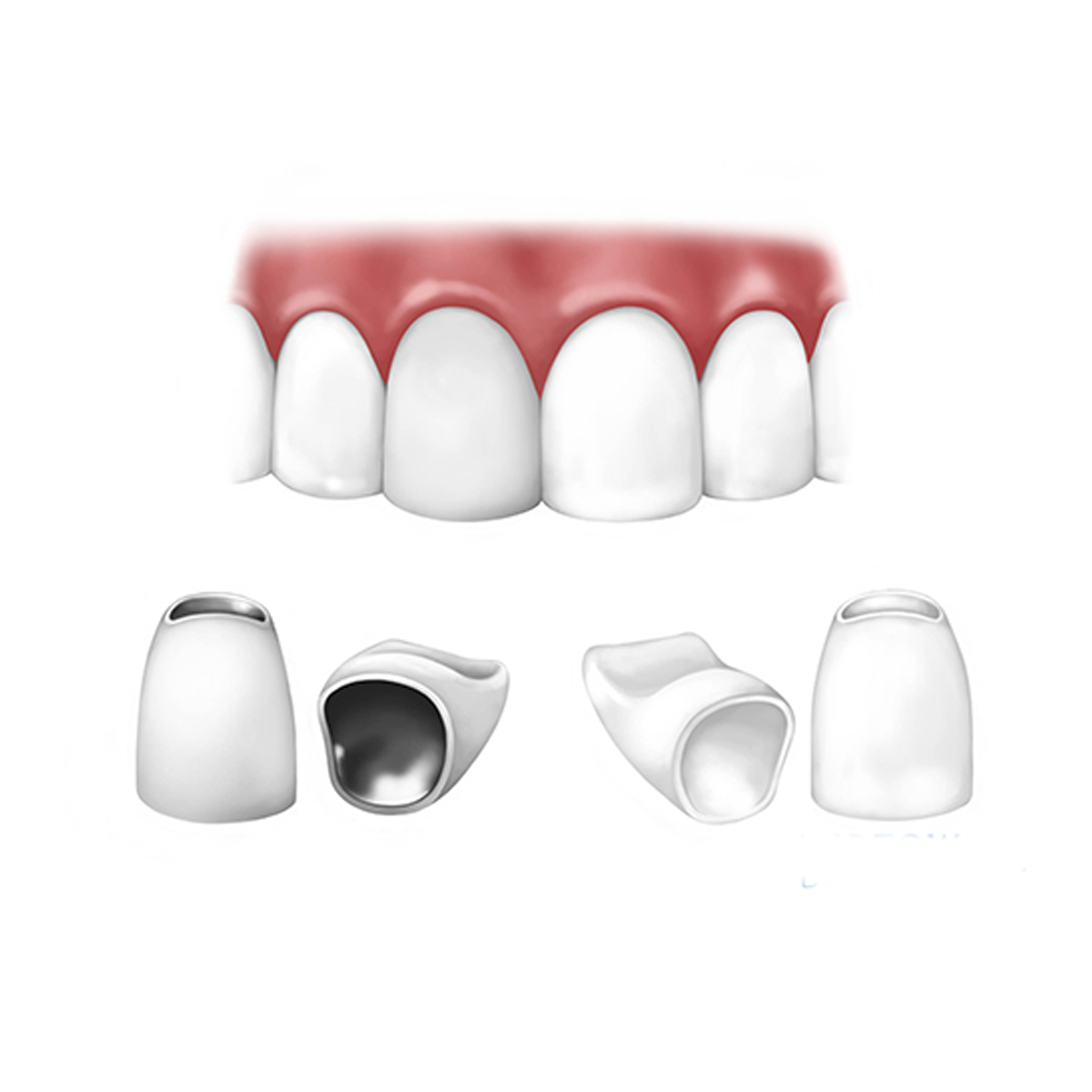 Răng sứ Lava 3M Esthetic (Mỹ)