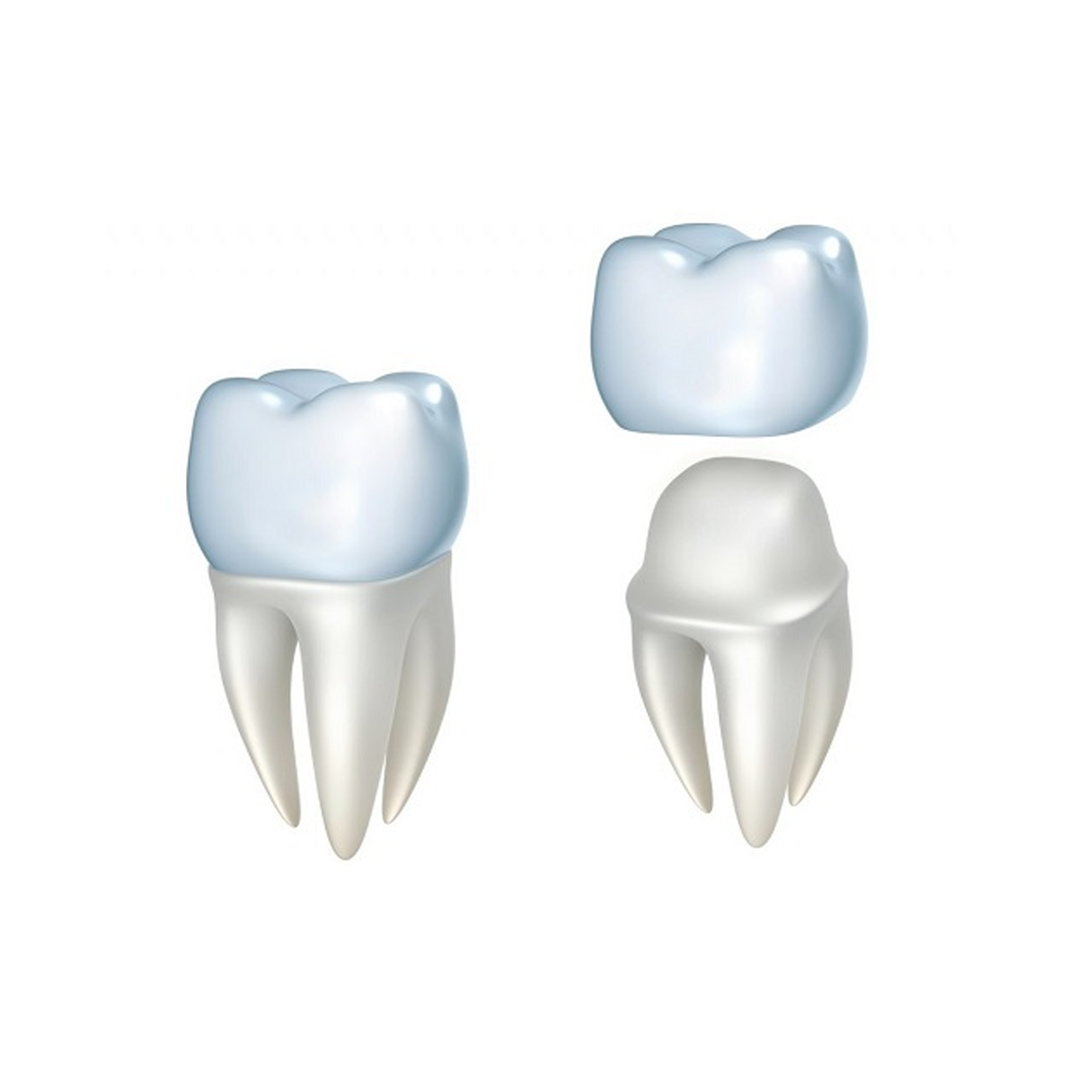 Răng sứ Orodent White Matt (Italia)