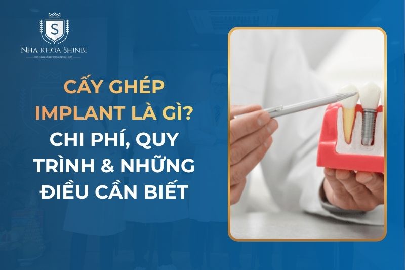 Cấy Ghép Implant Là Gì? Khắc Phục Mất Răng Như Thế Nào?