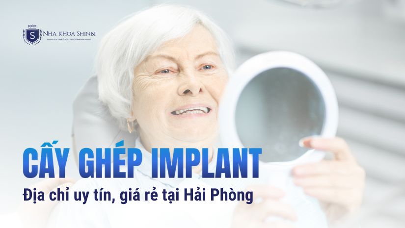 Danh sách 7 Địa chỉ cấy ghép Implant giá rẻ tại Hải Phòng