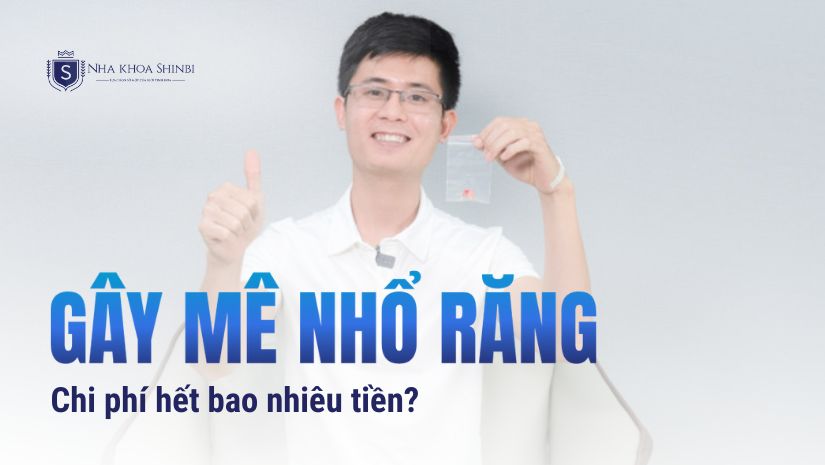Chi phí gây mê nhổ răng [Cập nhật bảng giá mới nhất 2025]