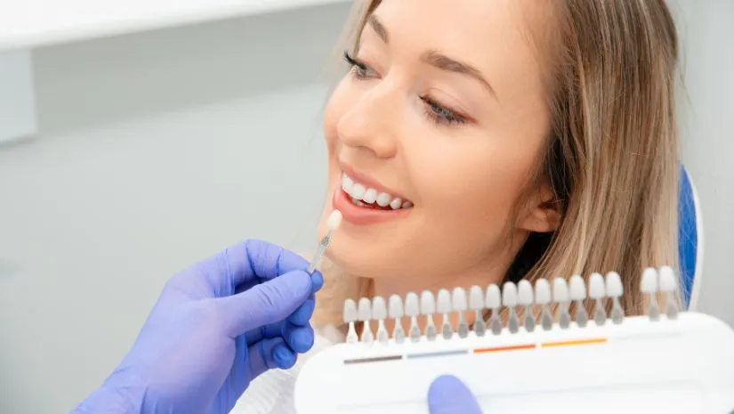 Dán sứ veneer được bao lâu? Cách kéo dài độ bền sứ tối đa