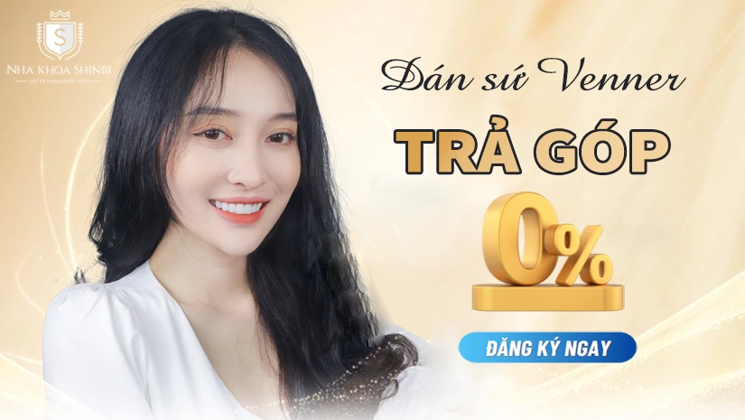 Dán sứ Veneer trả góp 0% lãi suất, nhận tiền sau 2 giờ