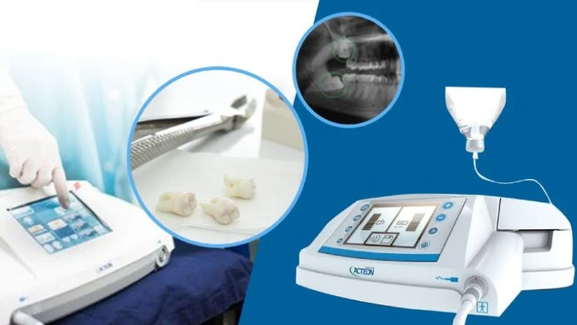 Bảng giá nhổ răng khôn bằng máy siêu âm mới nhất