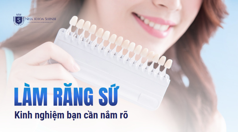 7 kinh nghiệm làm răng sứ thẩm mỹ bạn cần nắm rõ