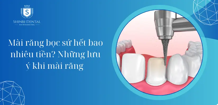 Mài răng bọc sứ hết bao nhiêu tiền? Bảng giá T