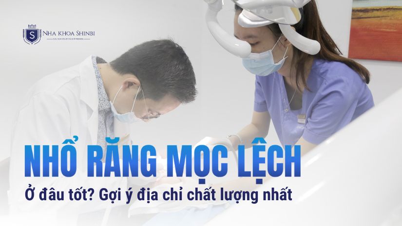 Nhổ răng mọc lệch ở đâu tốt? Gợi ý địa chỉ chất lượng nhất