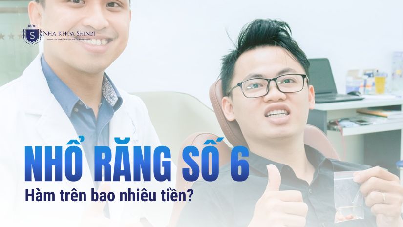Nhổ răng số 6 hàm trên bao nhiêu tiền tại Nha khoa Shinbi