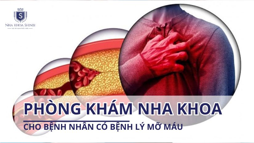 Phòng khám nha khoa cho bệnh nhân có bệnh lý mỡ máu