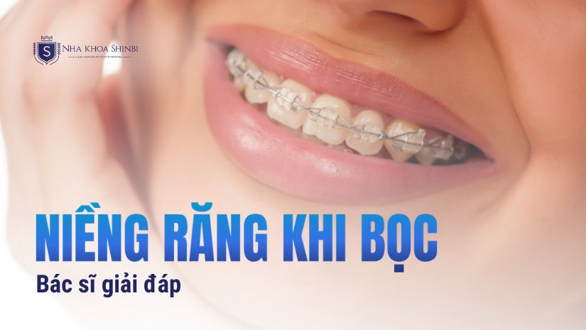 Răng bọc sứ rồi có niềng được không? [BÁC SĨ GIẢI ĐÁP]