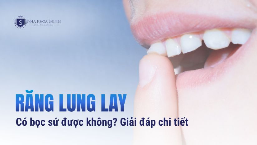 Răng lung lay có bọc sứ được không? [Bác sĩ giải đáp]