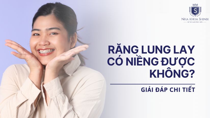 Răng lung lay có niềng được không? Giải đáp chi tiết