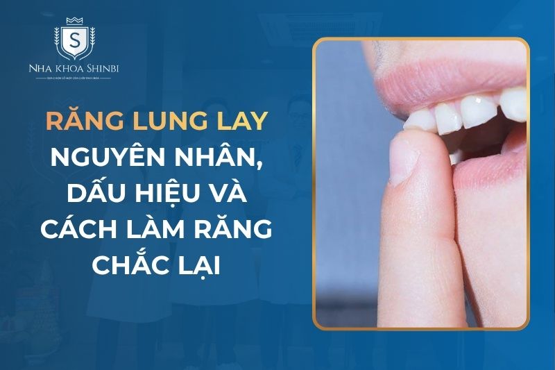 Răng Lung Lay: Nguyên Nhân, Dấu Hiệu Và Cách Làm Răng Chắc Lại