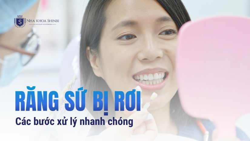 Răng sứ rơi ra phải làm sao? Các bước xử lý nhanh chóng